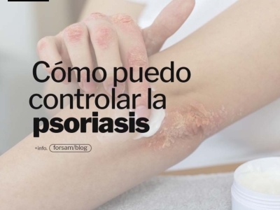 Psoriasis: Causas, síntomas y tratamientos para una piel saludable